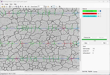 Stereology Analyzer 4.4.0